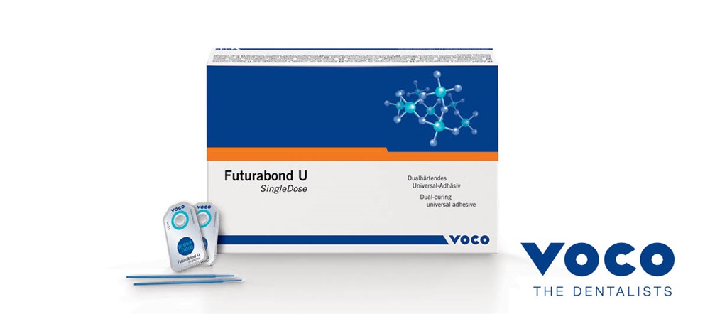 Product Profile: Futurabond U