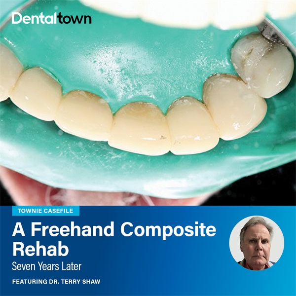 Townie Casefile: A Freehand Composite Rehab