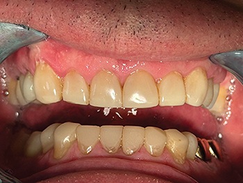 Townie Casefile: A Freehand Composite Rehab