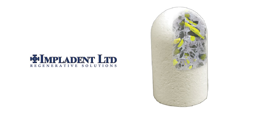 Product Profile: OsteoGen Bone Grafting Plug