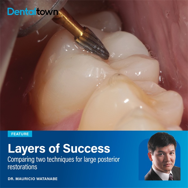 Layers of Success