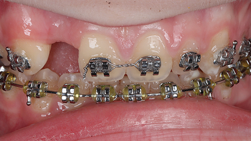 Townie Casefile: Digital Predictability Meets Composite Artistry