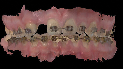 Townie Casefile: Digital Predictability Meets Composite Artistry