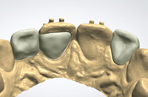 Townie Casefile: Digital Predictability Meets Composite Artistry