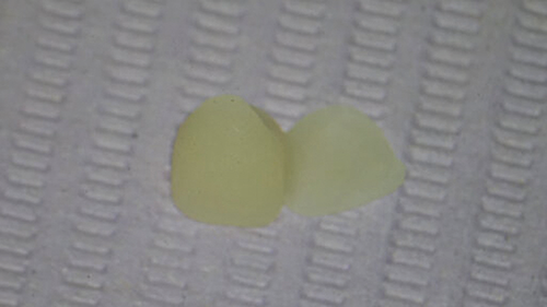 Townie Casefile: Digital Predictability Meets Composite Artistry