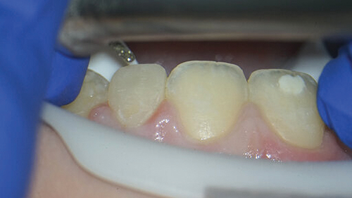 Townie Casefile: Digital Predictability Meets Composite Artistry