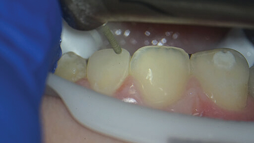 Townie Casefile: Digital Predictability Meets Composite Artistry