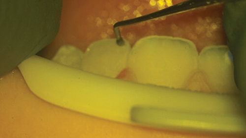 Townie Casefile: Digital Predictability Meets Composite Artistry