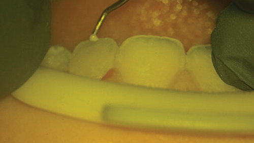 Townie Casefile: Digital Predictability Meets Composite Artistry