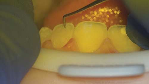 Townie Casefile: Digital Predictability Meets Composite Artistry