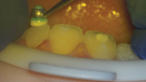 Townie Casefile: Digital Predictability Meets Composite Artistry