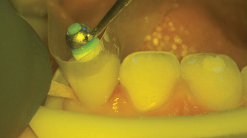 Townie Casefile: Digital Predictability Meets Composite Artistry