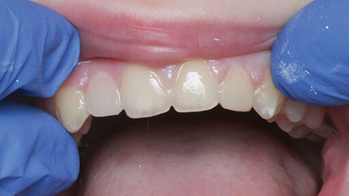 Townie Casefile: Digital Predictability Meets Composite Artistry