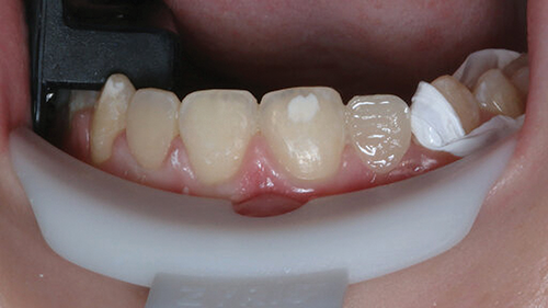 Townie Casefile: Digital Predictability Meets Composite Artistry