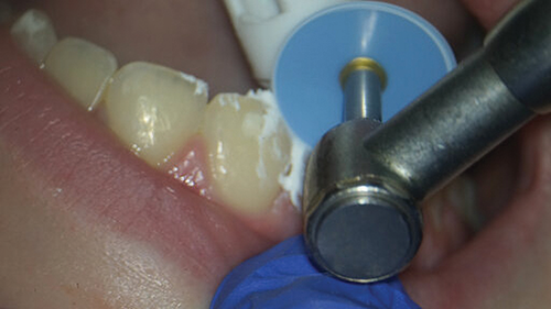 Townie Casefile: Digital Predictability Meets Composite Artistry