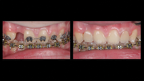 Townie Casefile: Digital Predictability Meets Composite Artistry