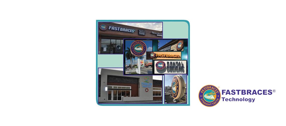 Product Profile: Fastbraces