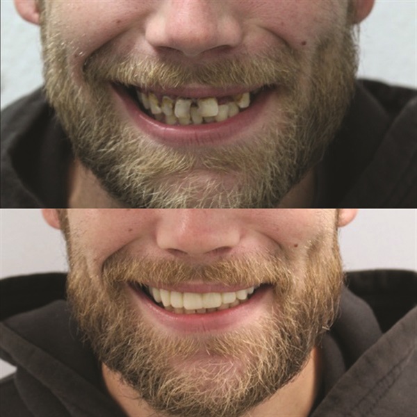 Townie Casefile: Mint for More