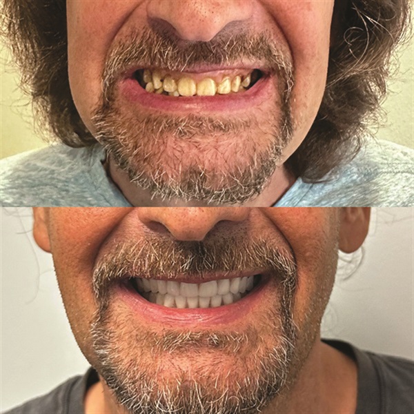 Townie Casefile: Mint for More