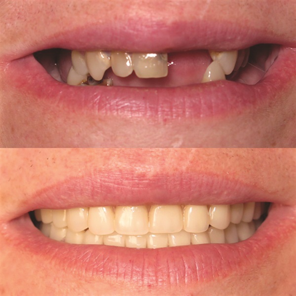 Townie Casefile: Mint for More