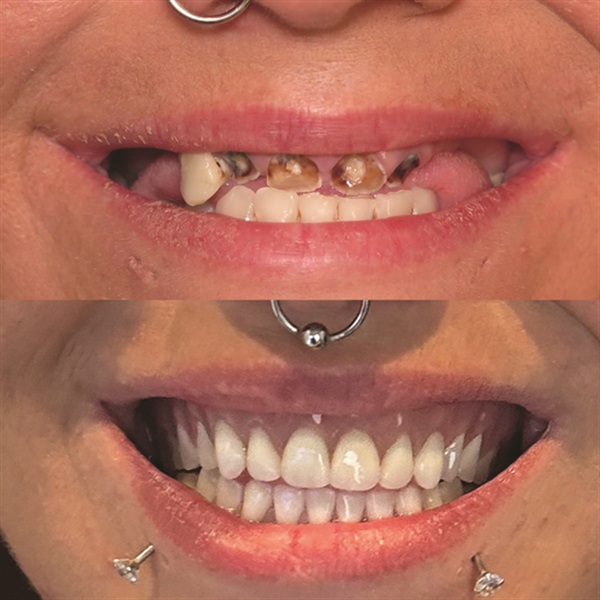 Townie Casefile: Mint for More