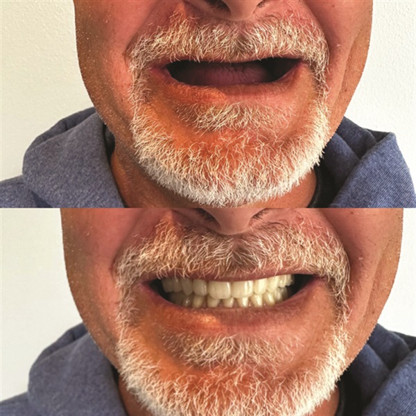 Townie Casefile: Mint for More