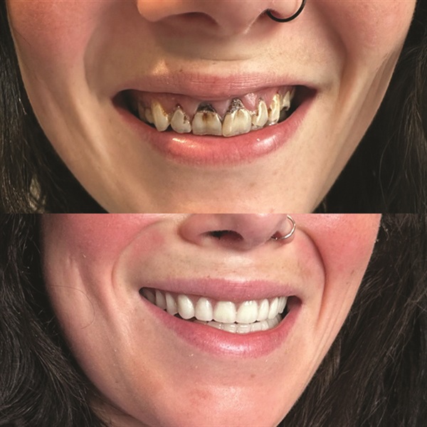 Townie Casefile: Mint for More