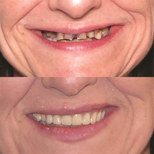 Townie Casefile: Mint for More