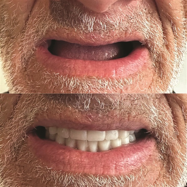 Townie Casefile: Mint for More