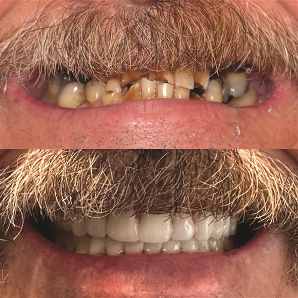 Townie Casefile: Mint for More