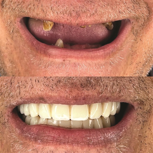 Townie Casefile: Mint for More