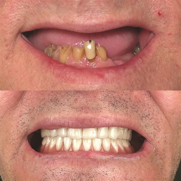 Townie Casefile: Mint for More