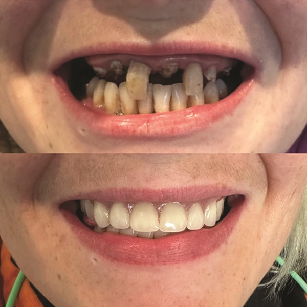 Townie Casefile: Mint for More