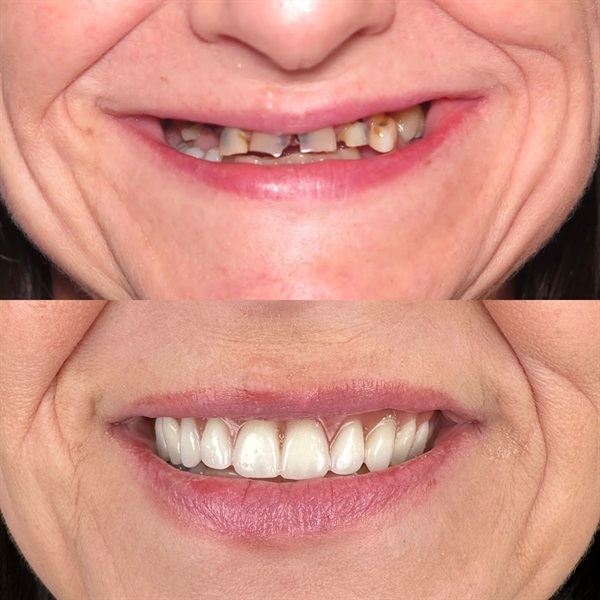 Townie Casefile: Mint for More