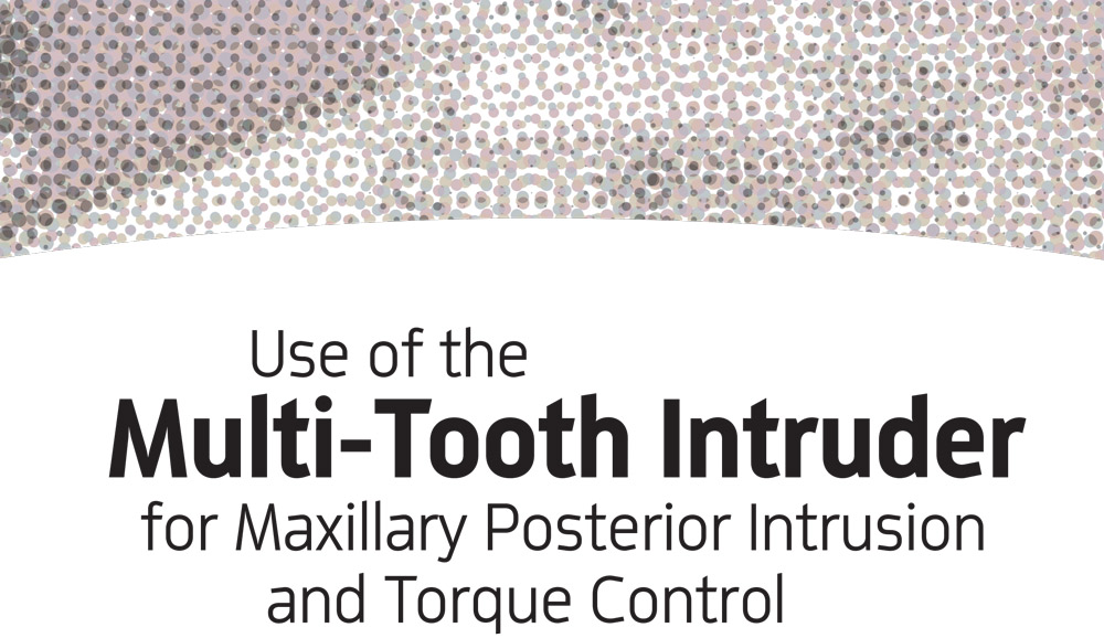 Multi-Tooth Intruder