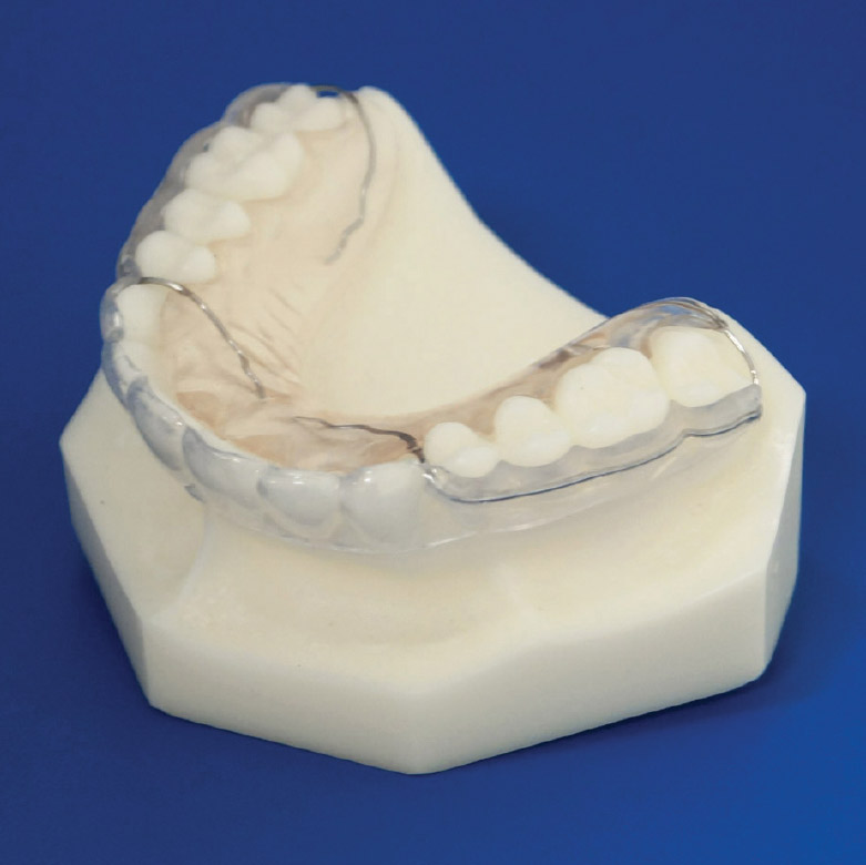 Great Lakes Orthodontic Bracket Line