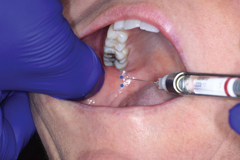 Dentaltown 5