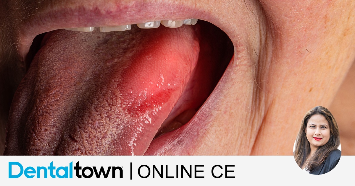 Oral Cancer: A Journey of Cancer, Grief and Finding a Purpose