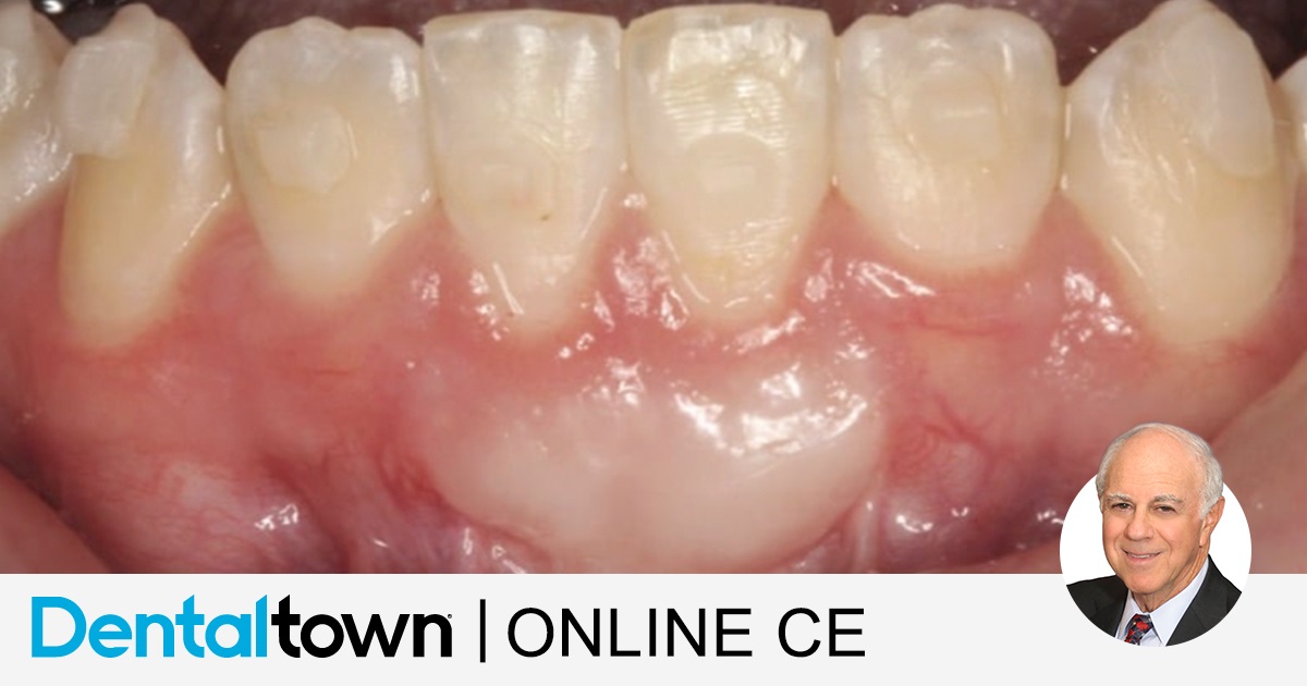 Improving Restorative Results with Soft Tissue Grafting