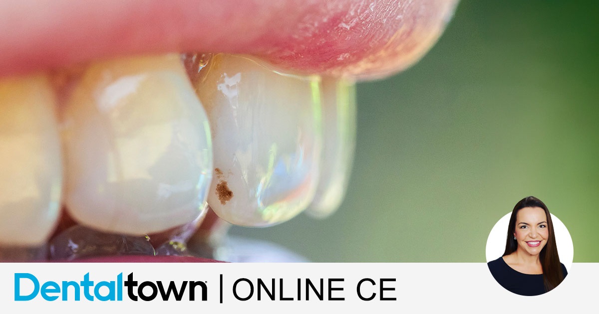 Dr. Jeanette MacLean White Spot, What Now? An Update on Incipient Caries Treatments
