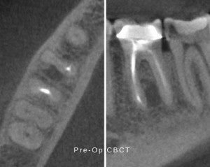 Pre-Op CBCT