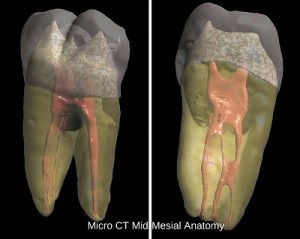 Pre-Op CBCT