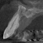 CBCT #1