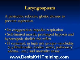 How to Recognize and Treat Laryngospasm