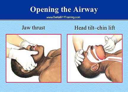 How to Recognize and Treat Laryngospasm