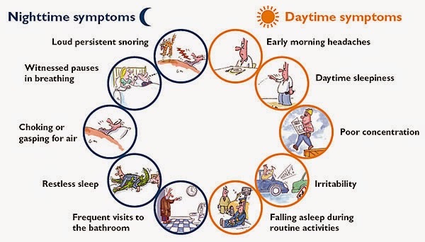 Patient Selection: Obstructive Sleep Apnea